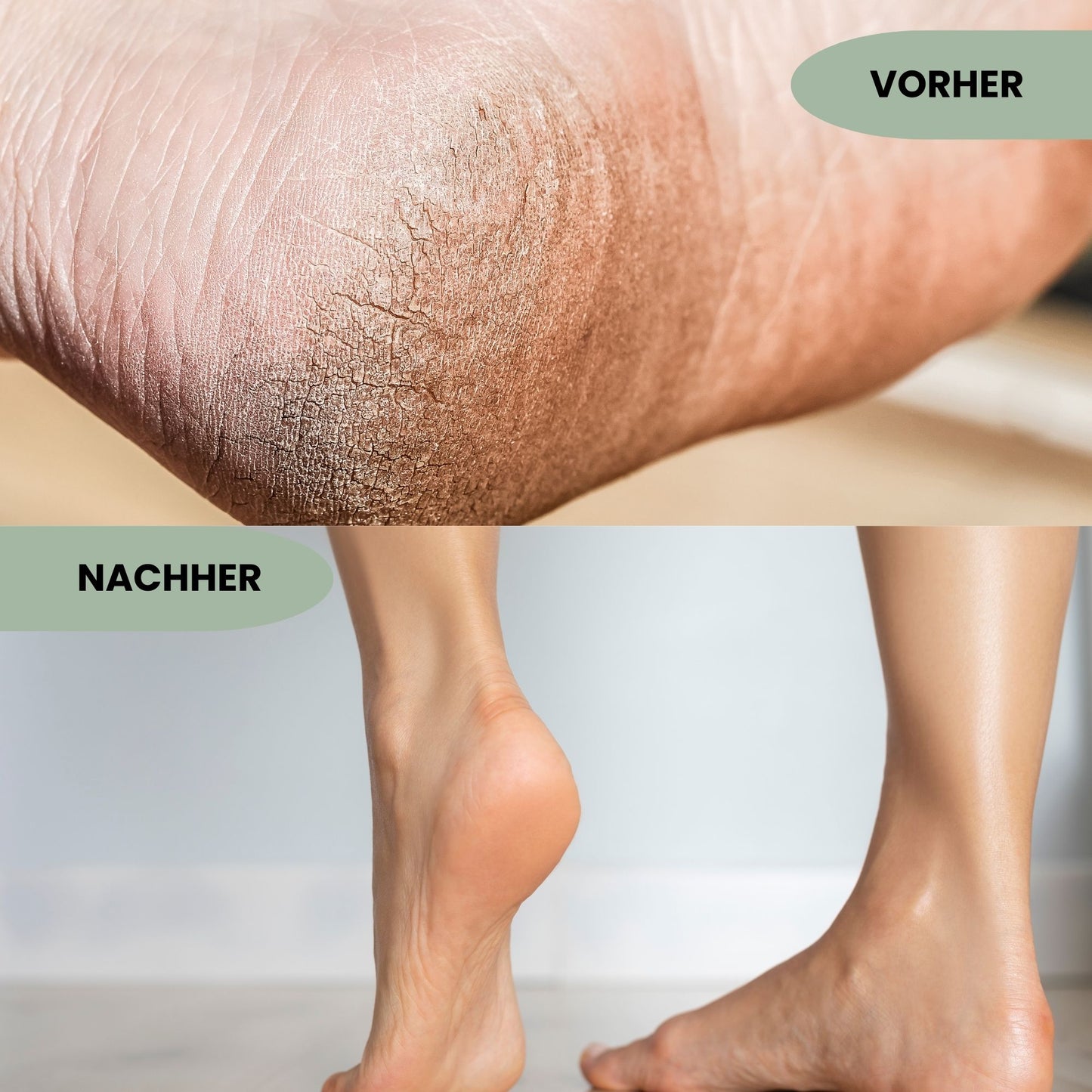 SilkyFeet One - Elektrischer Fußschleifer Pro